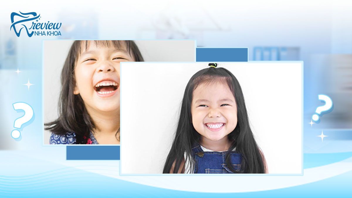 Trẻ 5 tuổi mọc răng hàm: Dấu hiệu, đặc điểm và cách xử lý đúng cha mẹ cần lưu ý