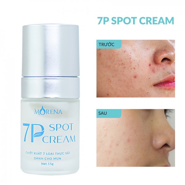 Kem chấm mụn 7P Spot Cream Huyền Phi – Giải pháp hoàn hảo cho làn da mụn