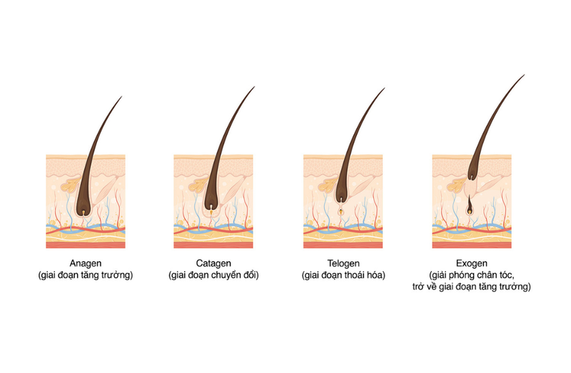 Triệt lông sau bao lâu thì rụng? Các yếu tố ảnh hưởng đến thời gian lông rụng